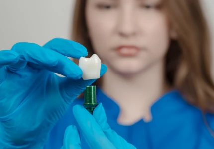 Dental Crowns