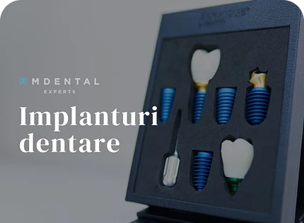 Impianti dentali: quando sceglierli e come trasformano il tuo sorriso